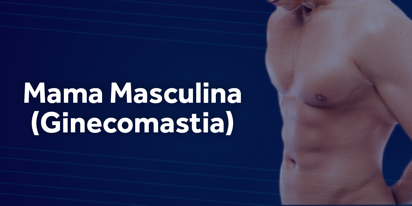 Ginecomastia (Mama Masculina)