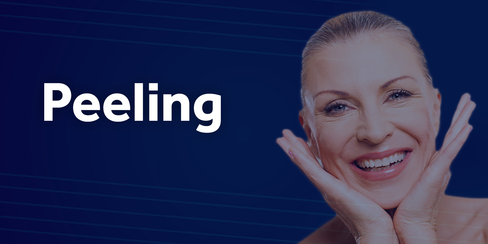 Peeling