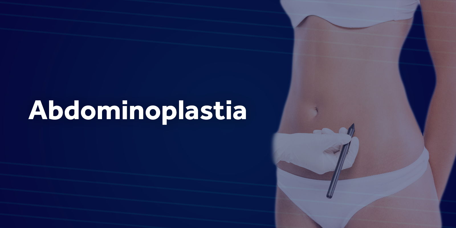 Abdominoplastia