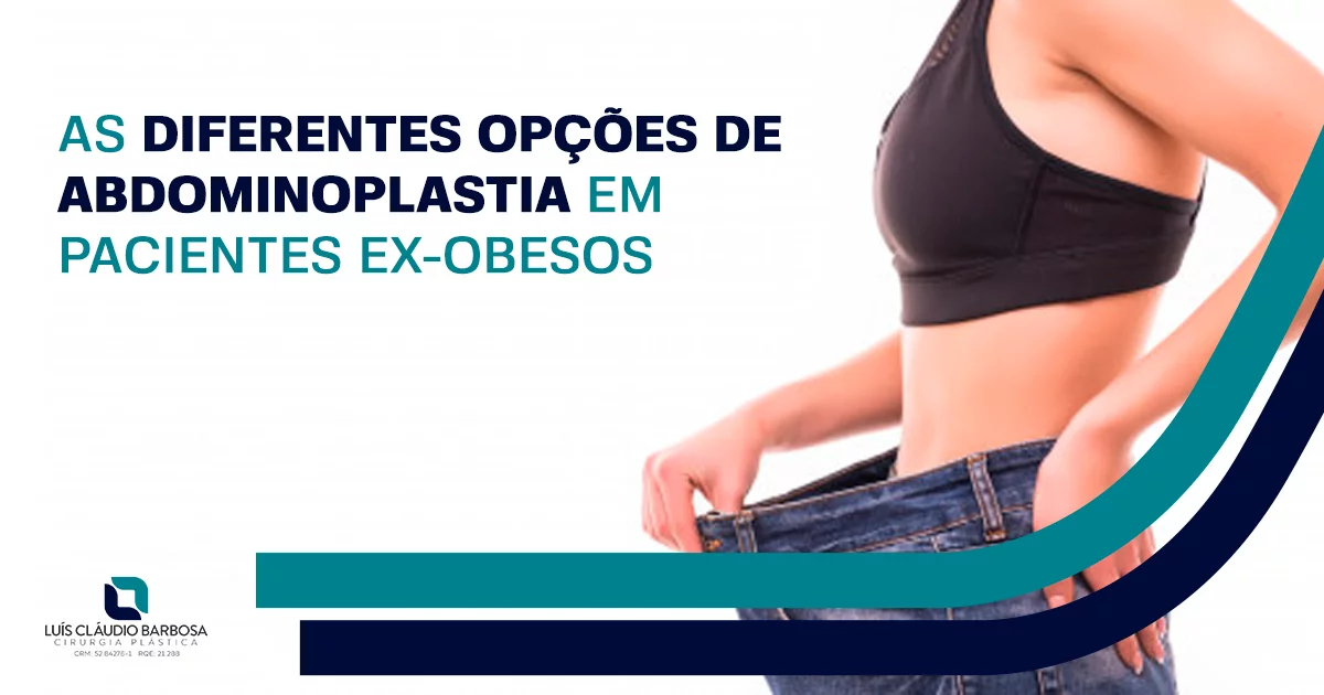 Tipos de abdminoplastia | DR. LUIS CLAUDIO BARBOSA